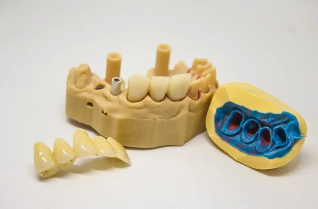 Dental mold with artificial teeth and braces setup.