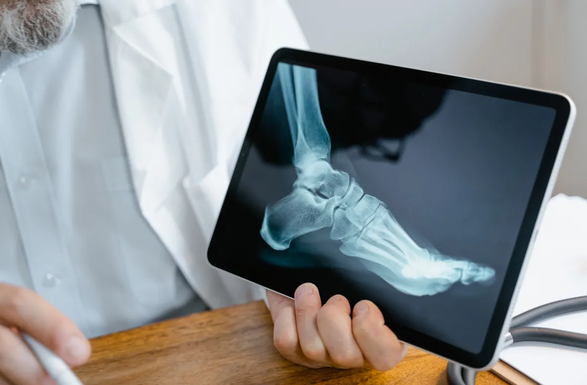 X-ray of a foot displayed on a tablet, indicating a possible fracture.